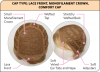 Simplify Wig by Natural Image